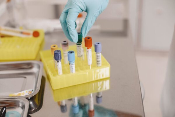 Analizele de rutină de la Clinica Sante: ce îți spun, de fapt, despre sănătatea ta